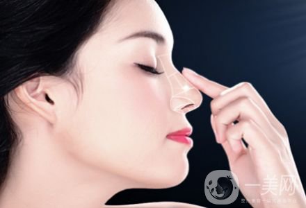 自體隆鼻手術(shù)價(jià)格 自體脂肪填充的方法