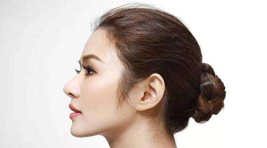 假體隆鼻要花多少錢 假體隆鼻*果好嗎？