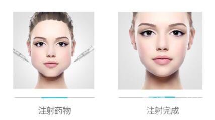 *的價(jià)位是多少 *有危害嗎