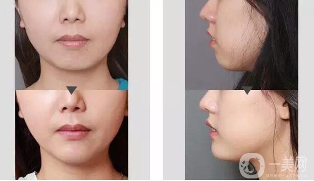 *的價(jià)位是多少 *有危害嗎