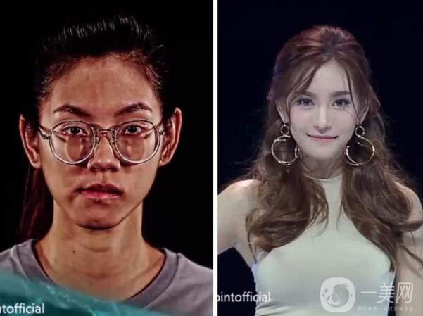 整容對人生的改變真的大嗎 整容后的人生變好了嗎