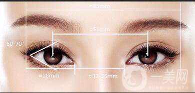 三點(diǎn)定位雙眼皮,全切,埋線