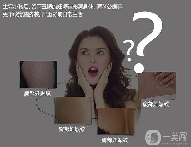 去妊娠紋價(jià)錢是多少？