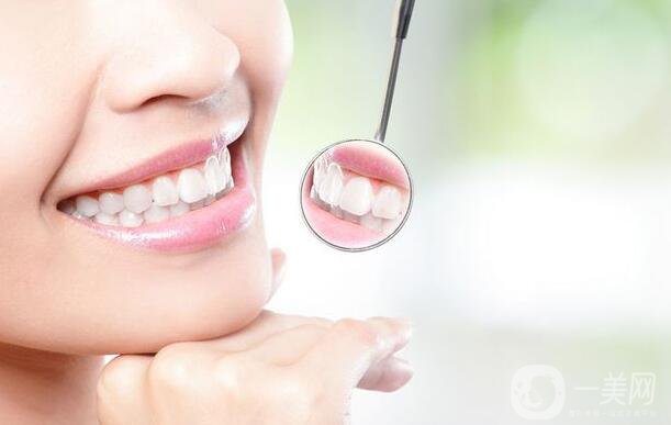 目前烤瓷牙種類有哪些？