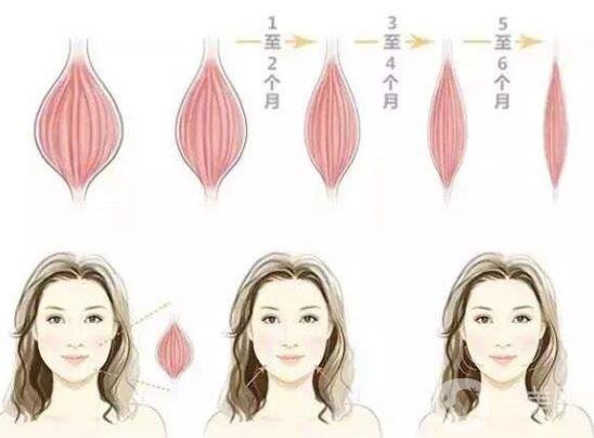 *能維持多長時間 注射*注意事項