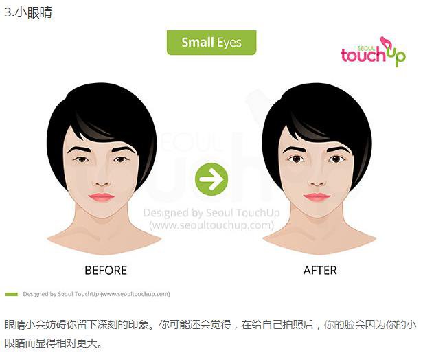 韓國(guó)做雙眼皮手術(shù)常見的5個(gè)問題解答