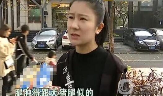 驚！女子花5萬整形，大腿留下17厘米疤痕