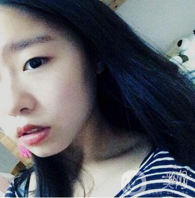 整容到底為了什么？知乎回答扎進(jìn)心窩