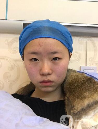 整容到底為了什么？知乎回答扎進(jìn)心窩