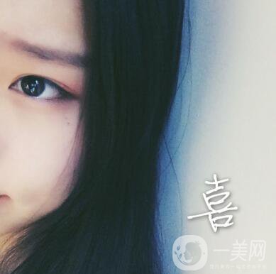 整容到底為了什么？知乎回答扎進(jìn)心窩