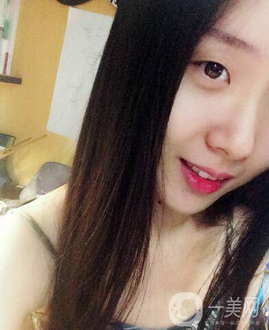 整容到底為了什么？知乎回答扎進(jìn)心窩