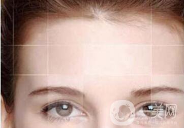 膨體豐額頭, 膨體豐額頭價格