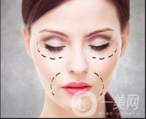 拉皮手術(shù)除皺*果,拉皮手術(shù)除皺術(shù)后護(hù)理