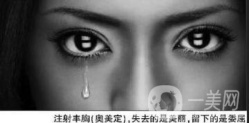 胸部奧美定取出要注意什么