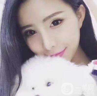 什么是芭比眼平行雙眼皮？