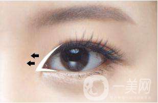 韓式*開眼角多少錢 開眼角有風險嗎