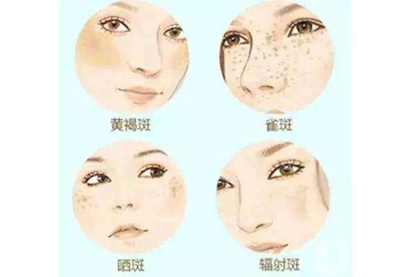 光子嫩膚大概要多少錢 光子嫩膚自然嗎