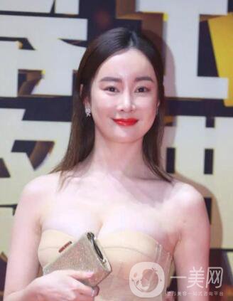 明星整容就是不承認(rèn)？ 然后突然臉“爛”了！