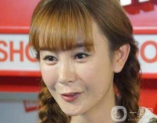 明星整容就是不承認(rèn)？ 然后突然臉“爛”了！