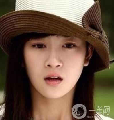 明星整容就是不承認(rèn)？ 然后突然臉“爛”了！