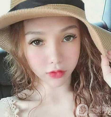 女子被前男友嫌丑 怒花12萬(wàn)整容成美女