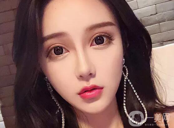 注射隆鼻好嗎 有哪些缺點(diǎn)呢？