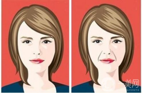 玻尿酸去法令紋價格多少 玻尿酸去法令紋的*果