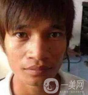 小伙整容數(shù)十次，只為一張韓星臉