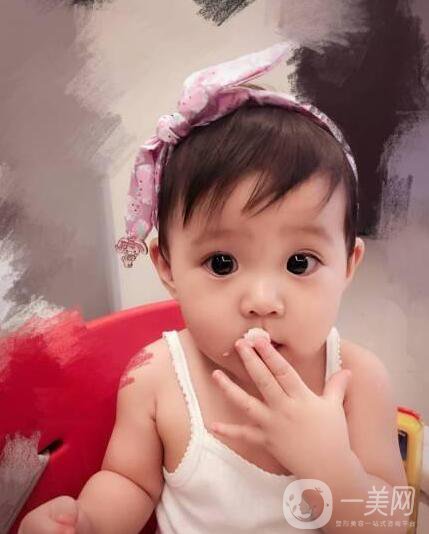 賈靜雯、迪麗熱巴的雙眼皮是不是割的 看了這個(gè)你就明白了