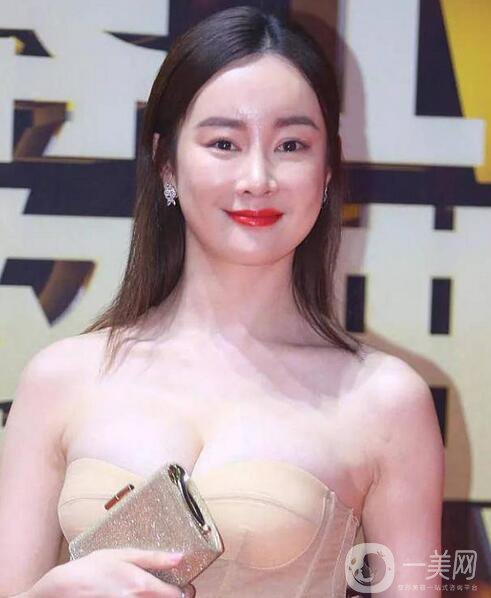 賈靜雯、迪麗熱巴的雙眼皮是不是割的 看了這個(gè)你就明白了