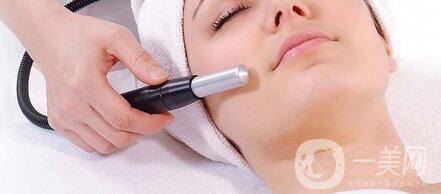 電波拉皮維持時間