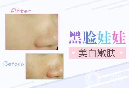 黑臉娃娃*果,黑臉娃娃優(yōu)勢