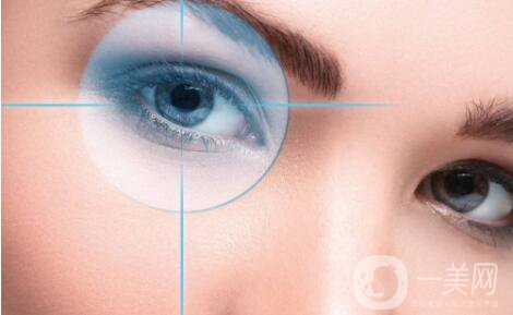 開眼角手術前后 開眼角手術后注意事項