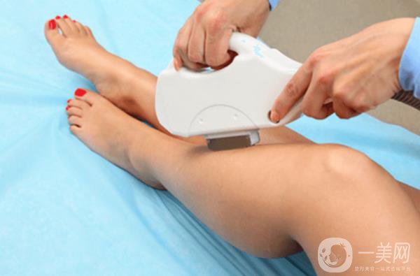 激光脫毛怎么樣？有什么優(yōu)勢？