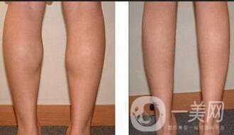 **果,*注意事項(xiàng)