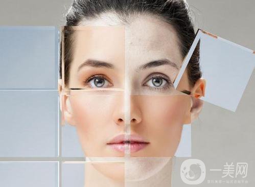 去法令紋多少錢 去法令紋的手術(shù)方法