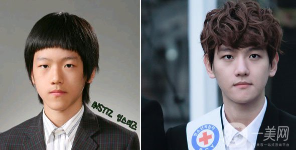 韓國(guó)3位進(jìn)行雙頜手術(shù)的明星 前后*果