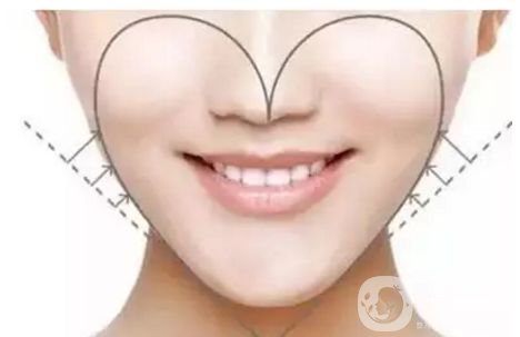 面部吸脂修復手術多少錢 面部吸脂恢復時間