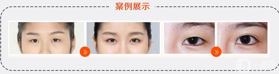 杭州臻美整形價(jià)格表2019版搶先看