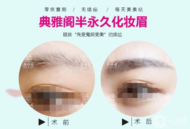 昆明典雅閣紋眉怎么樣？