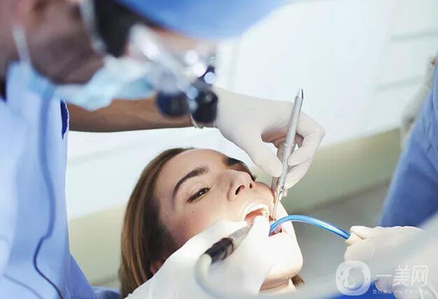 烤瓷牙的種類有哪些