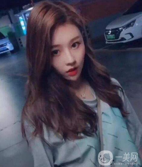 整容為什么越來越火？ 溫婉