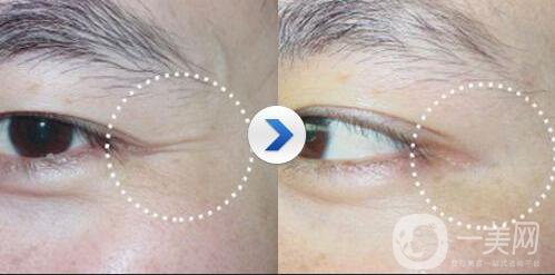 金瀚回應(yīng)丑帥男星，沒(méi)有整容的朱一龍也上榜了