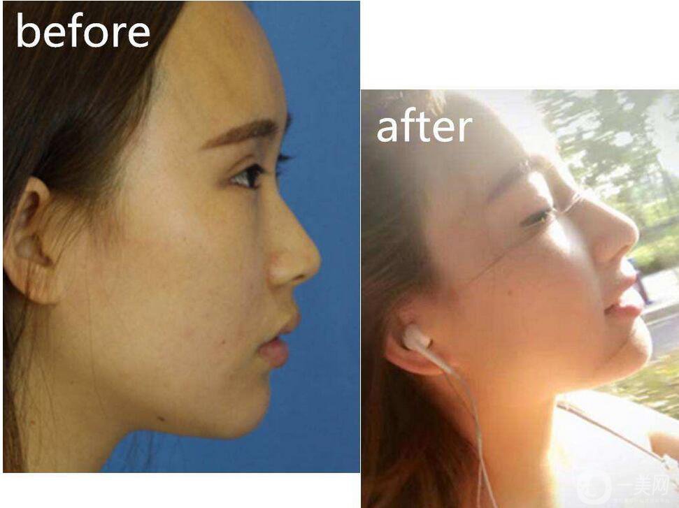 金瀚回應(yīng)丑帥男星，沒(méi)有整容的朱一龍也上榜了