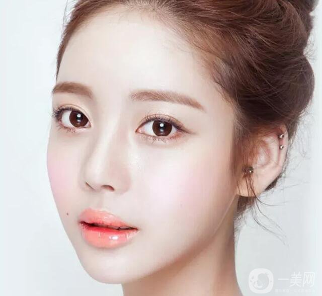 韓式開(kāi)眼角手術(shù)*果怎么樣？