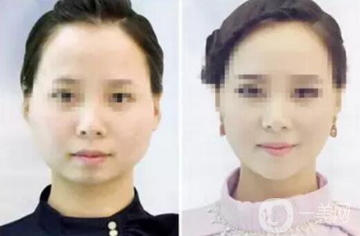 **果好嗎？*前后圖