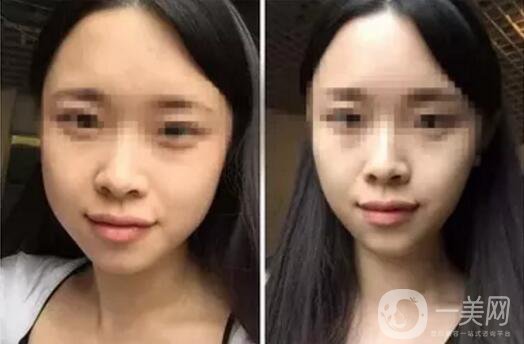 **果好嗎？*前后圖