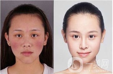 臉上很多紅血絲怎么辦？給你1個(gè)小法寶和紅血絲說(shuō)再見(jiàn)