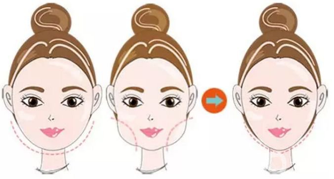 哪些明星做了顴骨內(nèi)推 顴骨內(nèi)推注意事項(xiàng)