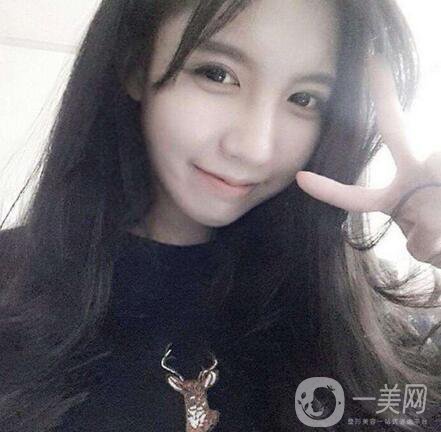 正頜手術(shù)的方法有哪些？